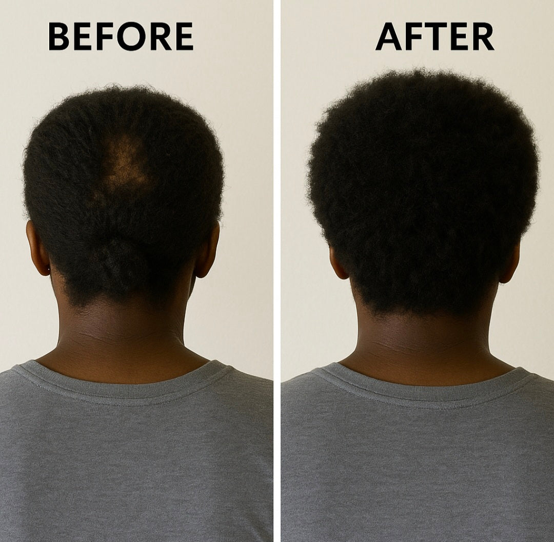 Crown Revival Herbal Hair Oil- With Ayurvedic Herbs (4oz/118ml)