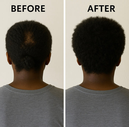 Crown Revival Herbal Hair Oil- With Ayurvedic Herbs (2oz/60ml)